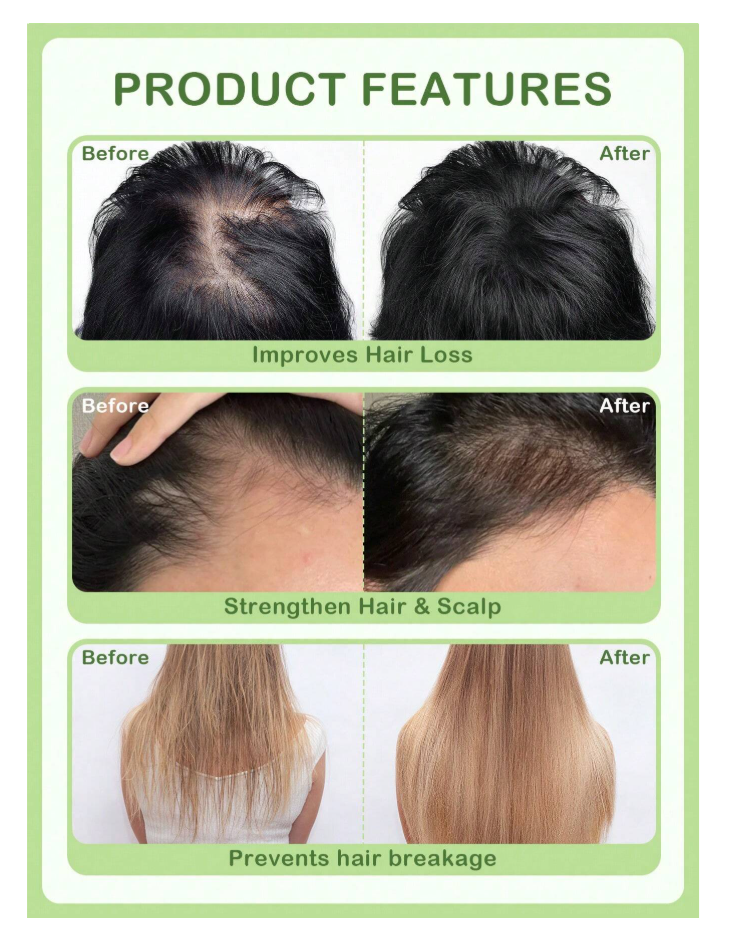 Rosemary Oil for Hair Growth and Strengthening (15ml)